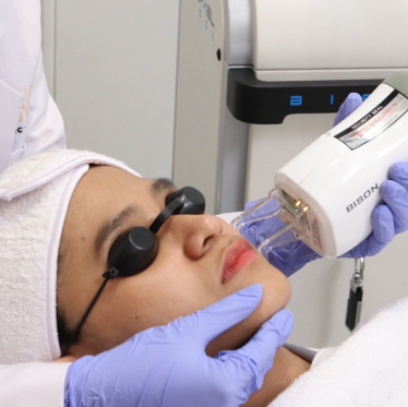 CRYSTAL LASER Treatment